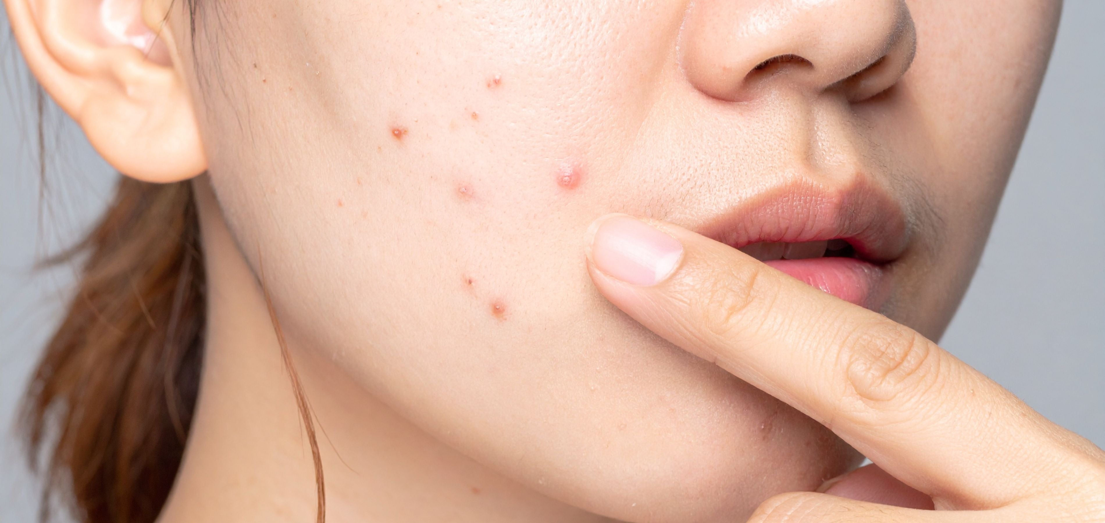 كيفية تقليل البقع الداكنة وتوحيد لون البشرة بطريقة طبيعية