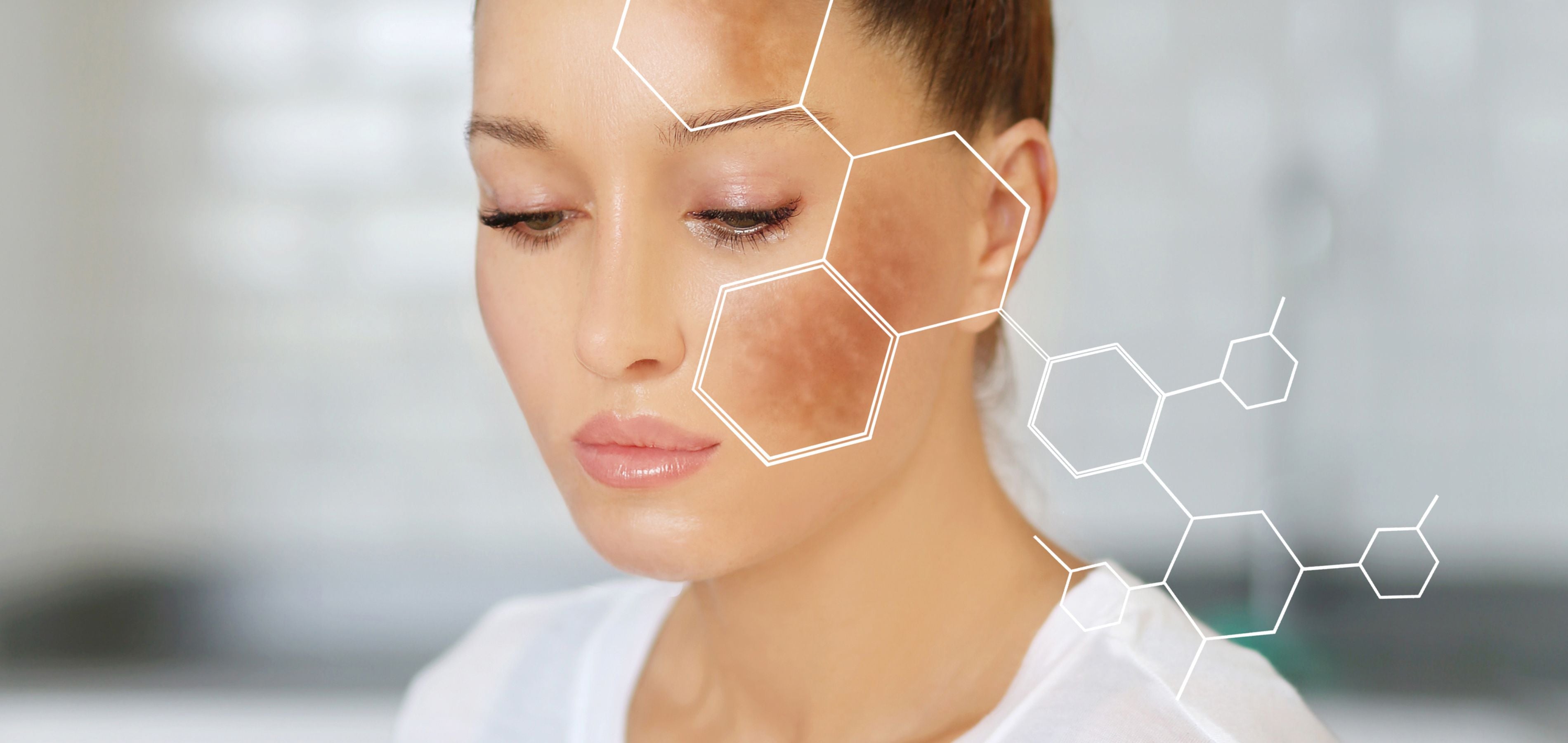 العلاج بالوجه المتجمد: الحيلة الجمالية الشهيرة التي تصغر المسام وتزيد الإشراقة